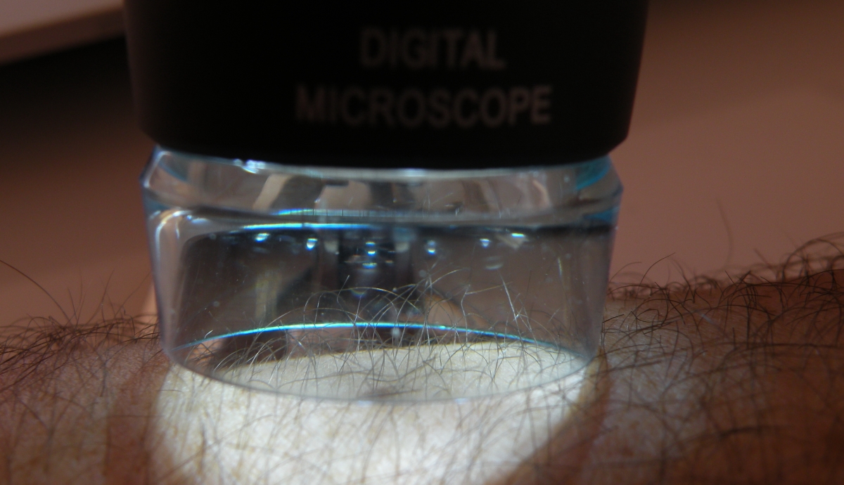 Digital Microscope 1200%Cabinet medical dermatologie Elena Zentrum Iasi
